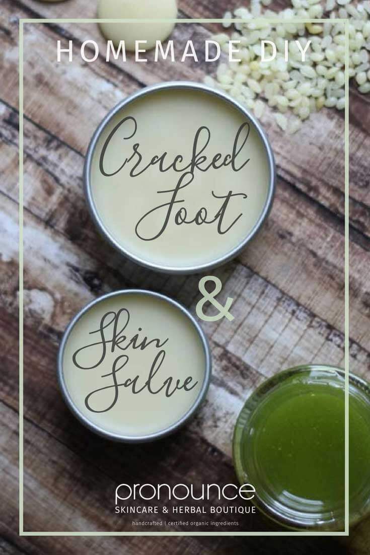 A super simple, crazy effective DIY Cracked Foot and Heel Salve Recipe which wil...