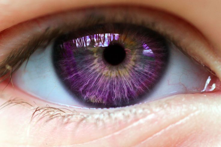 Alexandria’s Genesis, also known as ”violet eyes” (a mutation). It does no...