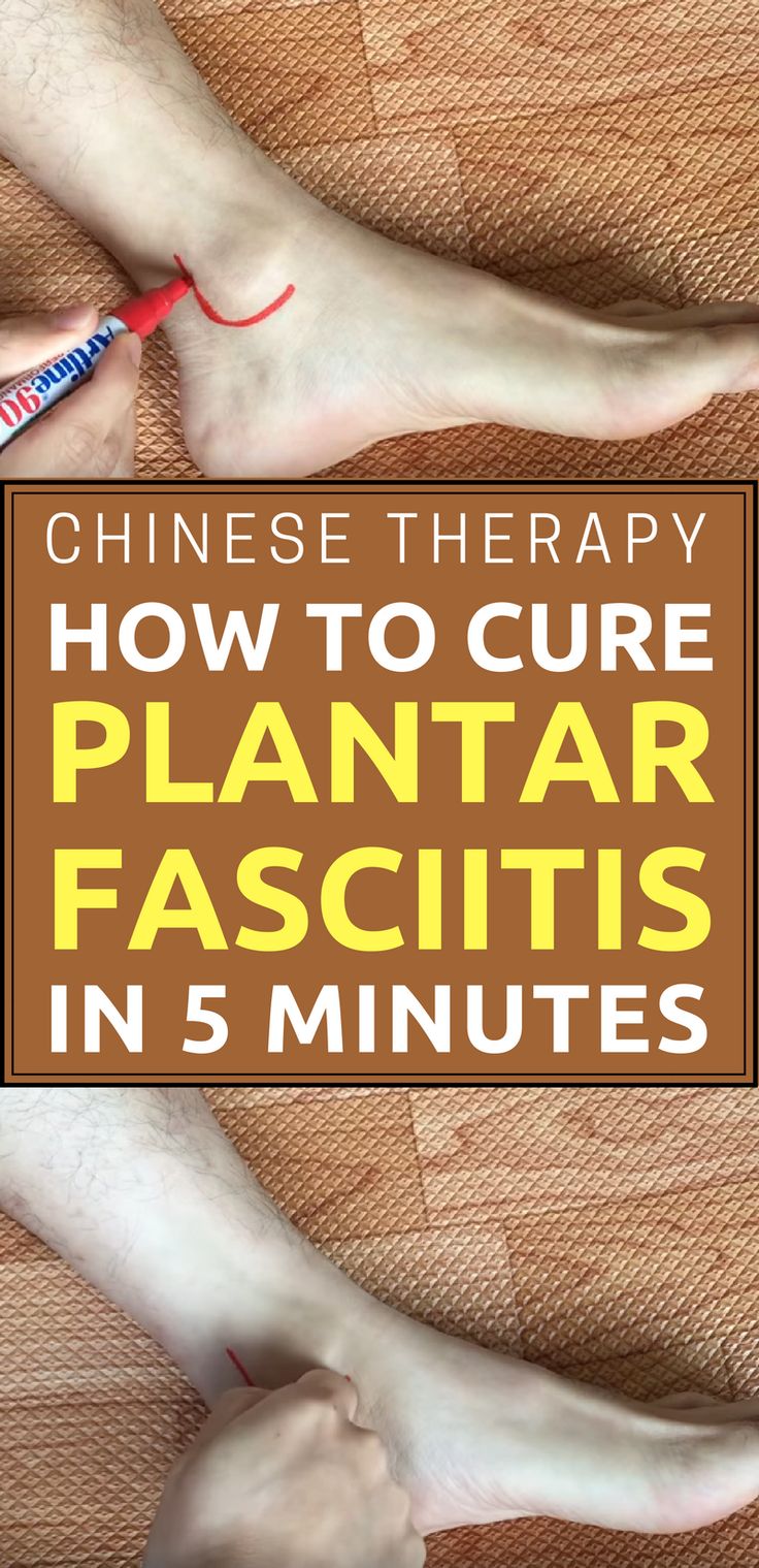 Chinese Therapy: How To Cure Plantar Fasciitis (Heel Pain) in 5 minutes #plantar...