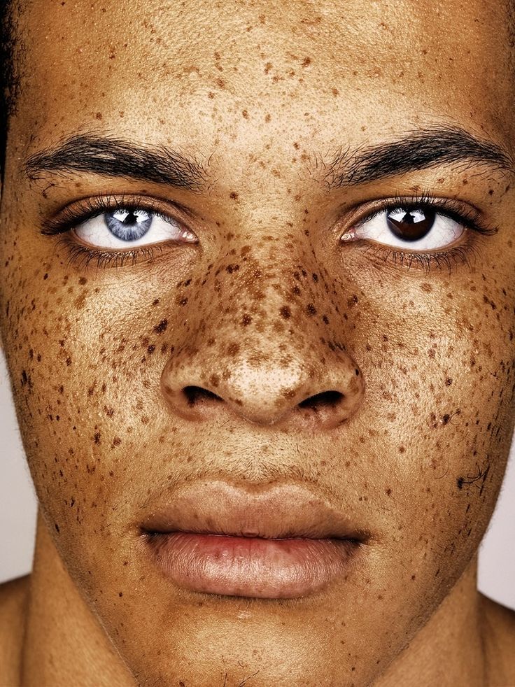 “From there on in, all I looked for was interesting freckled faces, of all age...