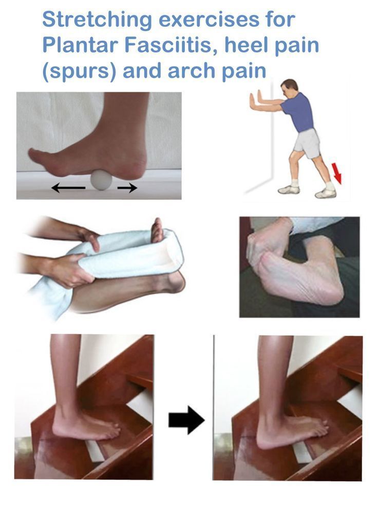 Stretching exercises for Plantar Fasciitis, heel pain (spurs) and arch pain  IMP...